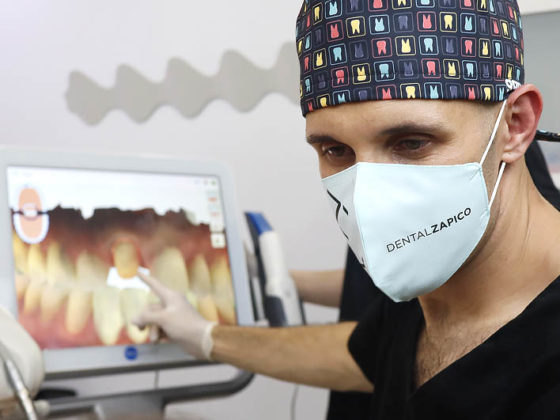 Dentista en Piedras Blancas realizando un escaneo intraoral. Las impresiones digitales ayudan a realizar tratamientos más precisos y menos invasivos