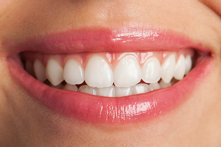 Clínica Dental Zapico. Periodontitis, causa de pérdida de dientes