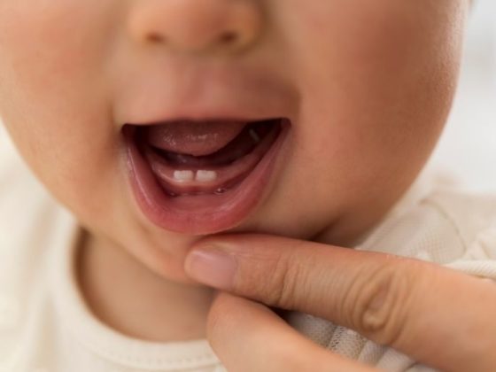 Trucos para la dentición que ayudan a la salud oral de tu bebé. Odontopediatría en Piedras Blancas.