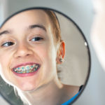 4 trucos de higiene para la ortodoncia fija Clinica Dental Zapico