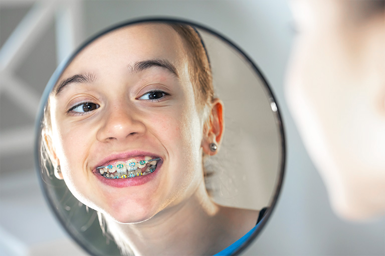 4 trucos de higiene para la ortodoncia fija Clinica Dental Zapico