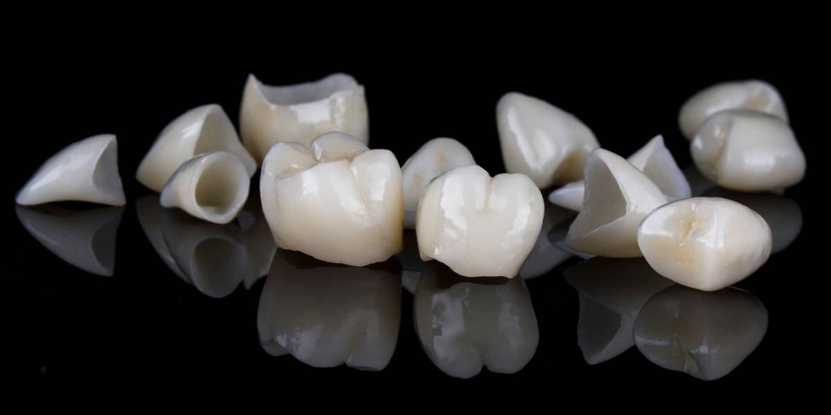 Carillas de porcelana listas para ser colocadas en la boca del paciente.