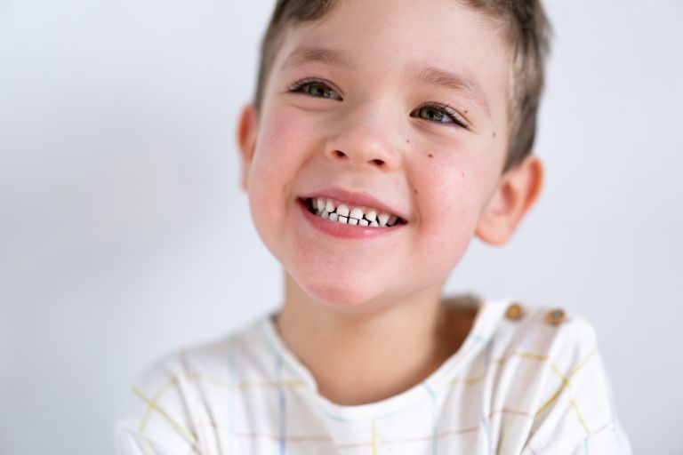 Niño sonriendo - Qué hacer cuando un niño tiene miedo al dentista - Zapico Dental - Odontopediatría en Piedras Blancas